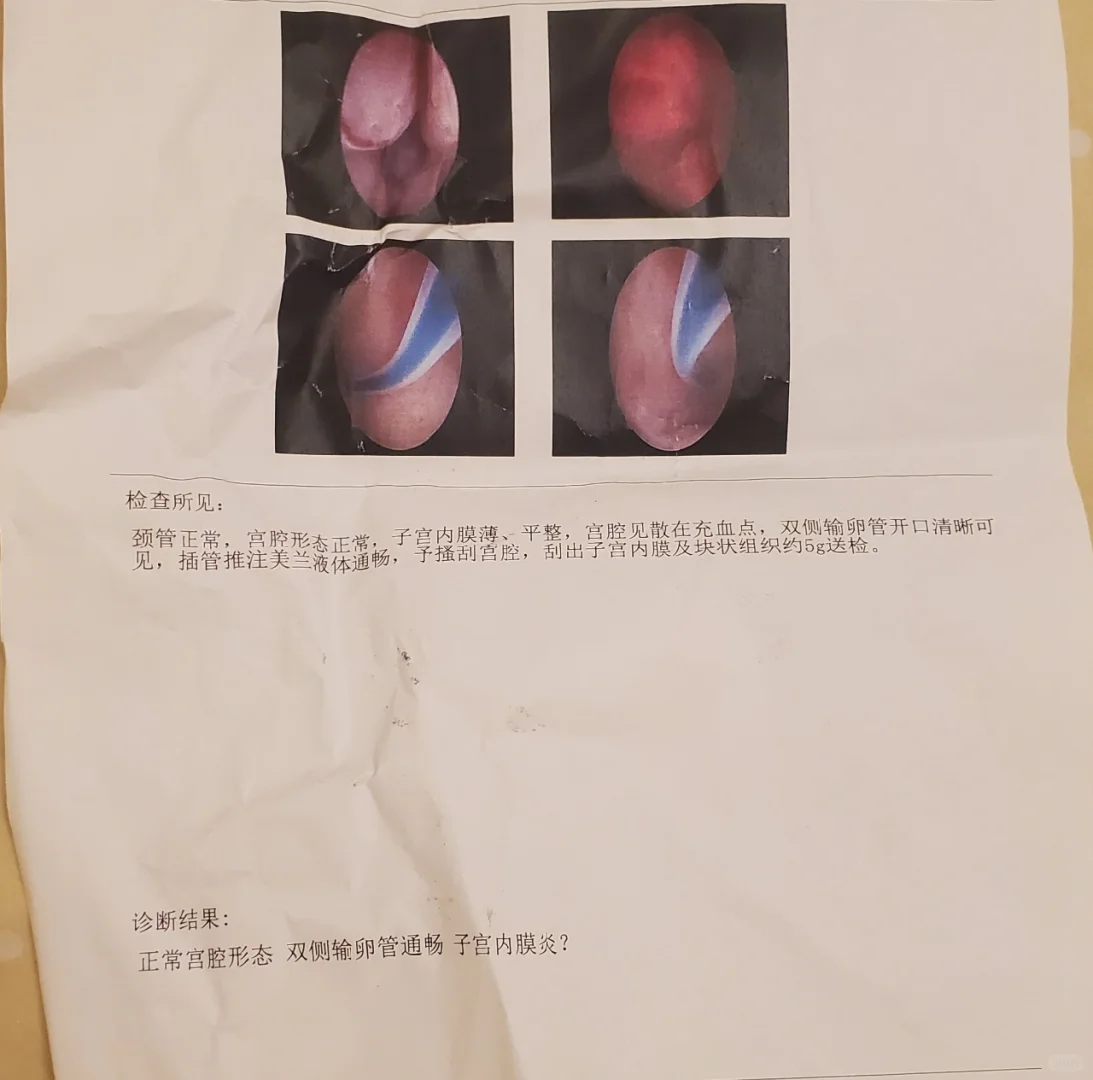 苏州辅助生殖圆梦：2025年费用明细与关键考量